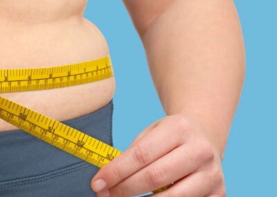 Lipedema ou obesidade? Especialista aponta diferenças entre os quadros