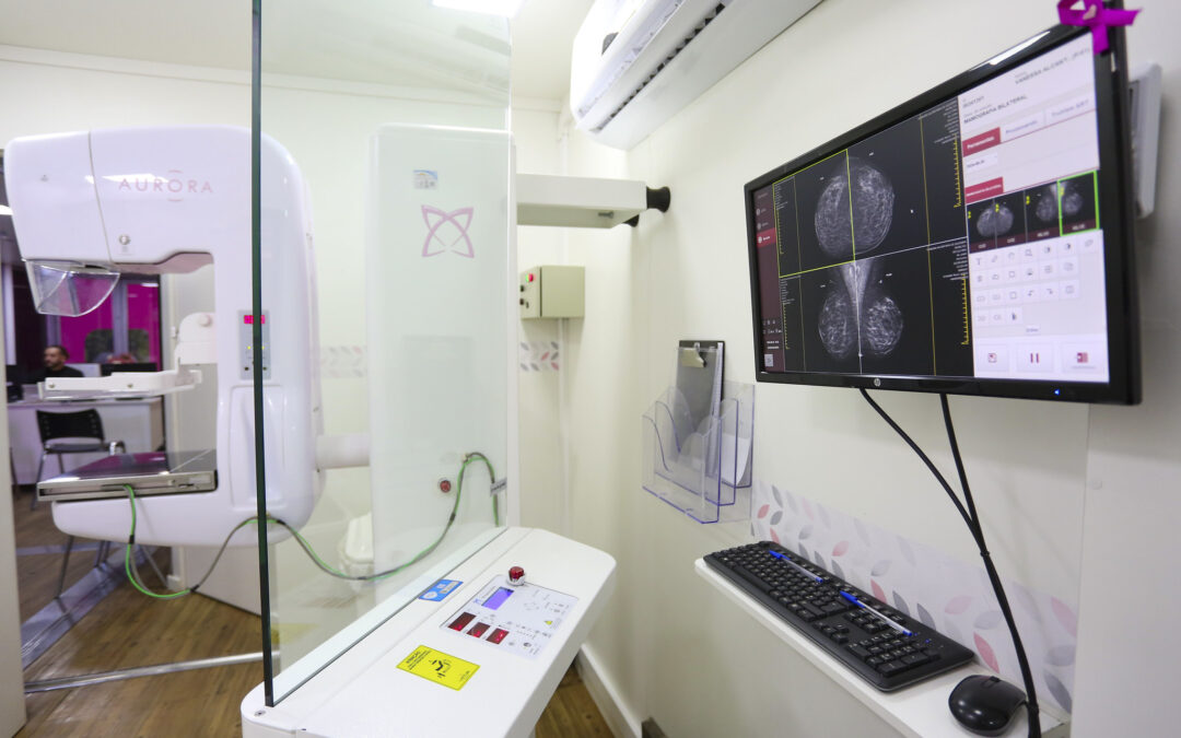 Carretas de Mamografia oferecem exames gratuitos em cinco municípios de São Paulo