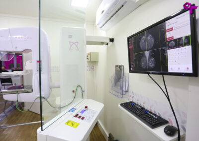 Carretas de Mamografia oferecem exames gratuitos em cinco municípios de São Paulo